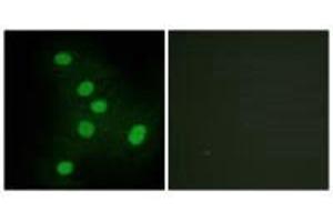 Immunofluorescence analysis of HepG2 cells, using NR2F6 antibody. (NR2F6 antibody  (N-Term))