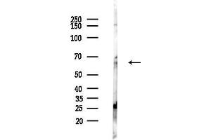 Western blot analysis of lysates from Mouse liver, using Collagen IX alpha 2 Antibody at 1/1000 dilution.