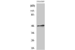 Western Blotting (WB) image for anti-AP2 alpha/beta (C-Term) antibody (ABIN3183305) (AP2 alpha/beta (C-Term) antibody)