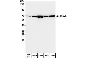 Western Blotting (WB) image for anti-CoaA (AA 550-600) antibody (ABIN7451577) (CoaA (AA 550-600) antibody)