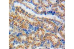 IHC-P analysis of Kidney tissue, with DAB staining. (GDNF antibody  (AA 78-211))