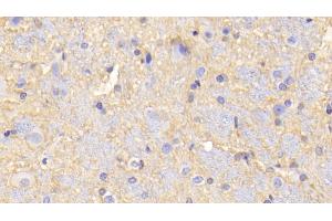 Detection of MAOA in Rat Cerebrum Tissue using Polyclonal Antibody to Monoamine Oxidase A (MAOA)