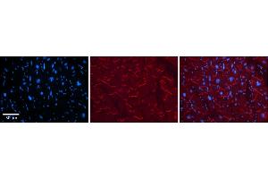 Rabbit Anti-KEAP1 Antibody    Formalin Fixed Paraffin Embedded Tissue: Human Adult heart  Observed Staining: Cytoplasmic (within intercalated disks) Primary Antibody Concentration: 1:600 Secondary Antibody: Donkey anti-Rabbit-Cy2/3 Secondary Antibody Concentration: 1:200 Magnification: 20X Exposure Time: 0.