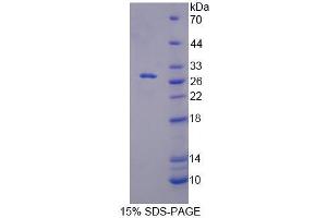 SDS-PAGE analysis of Mouse RFC5 Protein. (RFC5 Protein)