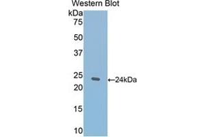 WB of Protein Standard: different control antibodies against Highly purified E. (Thrombospondin 1 CLIA Kit)