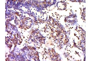 Paraformaldehyde-fixed, paraffin embedded mouse lymph, Antigen retrieval by boiling in sodium citrate buffer (pH6) for 15min, Block endogenous peroxidase by 3% hydrogen peroxide for 30 minutes, Blocking buffer (normal goat serum) at 37°C for 20min, Antibody incubation with 	Rabbit Anti-CX3CR1 Polyclonal Antibody, Unconjugated  at 1:500 overnight at 4°C, followed by a conjugated secondary and DAB staining. (CX3CR1 antibody  (AA 151-250))