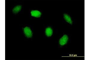 Immunofluorescence of purified MaxPab antibody to HIPK4 on HeLa cell. (HIPK4 antibody  (AA 1-616))