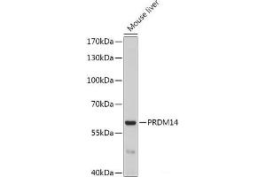 Western blot analysis of extracts of Mouse liver using PRDM14 Polyclonal Antibody at dilution of 1:1000. (PRDM14 antibody)