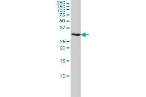 PCNA monoclonal antibody (M02), clone 1G7 Western Blot analysis of PCNA expression in Hela . (PCNA antibody  (AA 1-261))