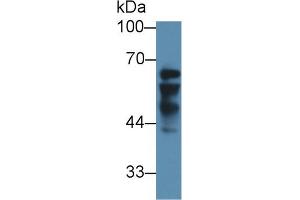 Western Blot; Sample: Human Liver lysate; Primary Ab: 3µg/ml Rabbit Anti-Human IGF2BP2 Antibody Second Ab: 0.