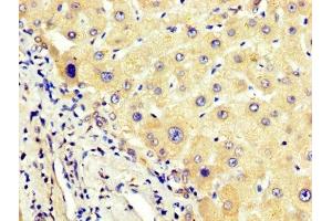 Immunohistochemistry (IHC) image for anti-Angiotensinogen (serpin Peptidase Inhibitor, Clade A, Member 8) (AGT) (AA 44-427) antibody (ABIN7144136)
