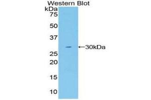 Western Blotting (WB) image for anti-Mindbomb E3 Ubiquitin Protein Ligase 1 (MIB1) (AA 769-1000) antibody (ABIN1859819) (MIB1 antibody  (AA 769-1000))