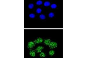 Confocal immunofluorescent analysis with Hela cells using MSH2 Antibody , followed by Alexa Fluor® 488-conjugated goat anti-rabbit lgG (green). (MSH2 antibody  (Middle Region))