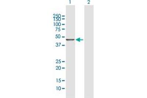 Western Blot analysis of DYX1C1 expression in transfected 293T cell line by DYX1C1 MaxPab polyclonal antibody.