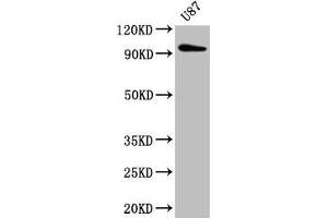 Western Blot Positive WB detected in: U87 whole cell lysate All lanes: TTLL6 antibody at 5 μg/mL Secondary Goat polyclonal to rabbit IgG at 1/50000 dilution Predicted band size: 97, 65 kDa Observed band size: 97 kDa (TTLL6 antibody  (AA 121-310))