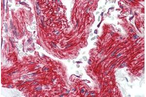 Human Vessel (formalin-fixed, paraffin-embedded) stained with ITGB1 antibody ABIN396958 at 10 ug/ml followed by biotinylated anti-mouse IgG secondary antibody ABIN481714, alkaline phosphatase-streptavidin and chromogen. (ITGB1 antibody)