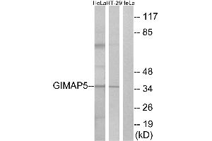 Immunohistochemistry analysis of paraffin-embedded human placenta tissue using GIMAP5 antibody. (GIMAP5 antibody  (Internal Region))
