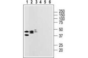 Western blot analysis of rat heart membranes (lanes 1 and 4), brain (lanes 2 and 5) and lung lysates (lanes 3 and 6): - 1-3. (P2RY14 antibody  (2nd Extracellular Loop))