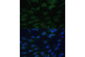 Immunofluorescence analysis of C6 cells using EIF1AX Polyclonal Antibody (ABIN6131999, ABIN6140017, ABIN6140018 and ABIN6221620) at dilution of 1:100 (40x lens). (EIF1AX antibody  (AA 10-144))