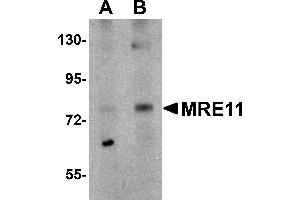 Western Blotting (WB) image for anti-MRE11 Meiotic Recombination 11 Homolog A (S. Cerevisiae) (MRE11A) (N-Term) antibody (ABIN1031460) (Mre11 antibody  (N-Term))