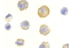 Image no. 2 for anti-Tumor Necrosis Factor Receptor Superfamily, Member 10c (TNFRSF10C) (Extracellular Domain) antibody (ABIN203554) (DcR1 antibody  (Extracellular Domain))