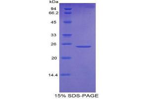 SDS-PAGE (SDS) image for Osteoclast Stimulating Factor 1 (OSTF1) (AA 10-215) protein (His tag) (ABIN2121804)