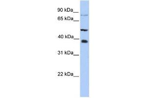 METTL2B antibody used at 1 ug/ml to detect target protein.