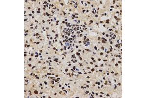 Immunohistochemistry of paraffin-embedded mouse liver fibrosis using PELP1 antibody (ABIN6292223) at dilution of 1:200 (40x lens). (PELP1 antibody)