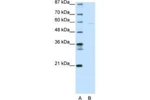 Western Blotting (WB) image for anti-SWI/SNF Related, Matrix Associated, Actin Dependent Regulator of Chromatin, Subfamily D, Member 3 (SMARCD3) antibody (ABIN2461185) (SMARCD3 antibody)