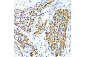 Immunohistochemistry of paraffin-embedded rat ovary using KMT2E antibody (ABIN6131786, ABIN6142983, ABIN6142984 and ABIN6221745) at dilution of 1:200 (40x lens).