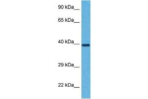 Host:  Rabbit  Target Name:  ST3GAL4  Sample Tissue:  Human 786-0 Whole Cell  Antibody Dilution:  1ug/ml (ST3GAL4 antibody  (Middle Region))