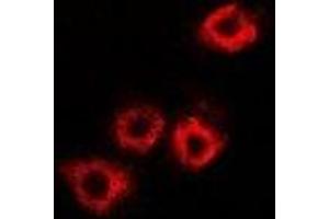 Immunofluorescent analysis of HADHB staining in A549 cells. (HADHB antibody)