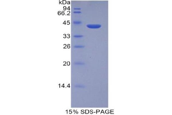 HIST2H2AA3 Protein