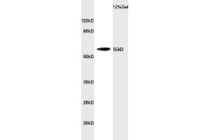 Mouse brain lysate probed with Rabbit Anti-CYP24A1 Polyclonal Antibody (ABIN750838) at 1:200 in 4 °C. (CYP24A1 antibody  (AA 351-450))