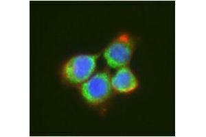 Immunofluorescence (IF) image for anti-DEAD (Asp-Glu-Ala-Asp) Box Polypeptide 6 (DDX6) antibody (ABIN2664929) (DDX6 antibody)