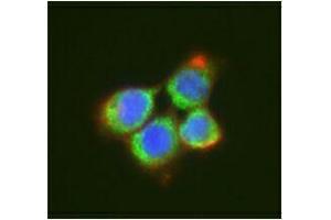 Immunofluorescence (IF) image for anti-DEAD (Asp-Glu-Ala-Asp) Box Polypeptide 6 (DDX6) antibody (ABIN2664929) (DDX6 antibody)