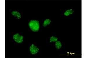 Immunofluorescence of purified MaxPab antibody to CALML3 on HeLa cell.