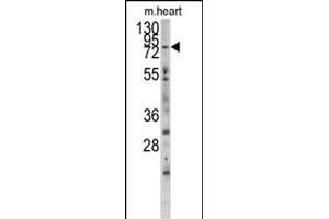 Western blot analysis of anti-MYLK3 Antibody (N-term) (ABIN392494 and ABIN2837985) in mouse heart tissue lysates (35 μg/lane). (MYLK3 antibody  (N-Term))