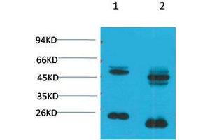 Western Blot (WB) analysis of 1) Rat Brain Tissue, 2)Mouse Brain Tissue with KV1. (KCNA10 antibody)