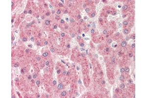 Immunohistochemistry (IHC) image for anti-Zinc Finger, CCCH-Type with G Patch Domain (ZGPAT) (AA 254-303) antibody (ABIN6754935)