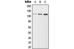 Western blot analysis of USP11 expression in Jurkat (A), SP2/0 (B), H9C2 (C) whole cell lysates. (USP11 antibody  (Center))