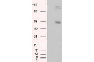 HEK293T cells were transfected with the pCMV6-ENTRY control (Left lane) or pCMV6-ENTRY LIPG (Right lane) cDNA for 48 hrs and lysed. (LIPG antibody)