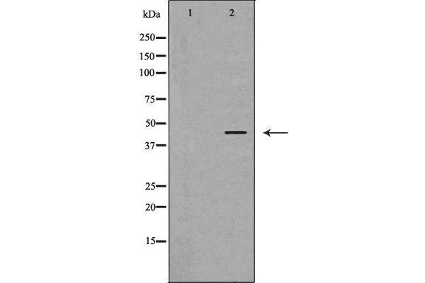 PRKAR1A antibody  (N-Term)