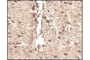 Immunohistochemistry of Rkhd1 in human small intestine tissue with this product at 2. (MEX3D antibody  (Center))