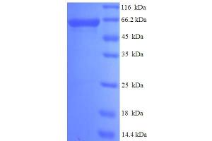 SDS-PAGE (SDS) image for P21-Activated Kinase 4 (PAK4) (AA 1-426) protein (His-SUMO Tag) (ABIN5710063)