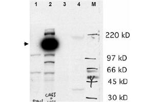 Image no. 1 for anti-Castor Zinc Finger 1 (CASZ1) (N-Term) antibody (ABIN401359) (CASZ1 antibody  (N-Term))