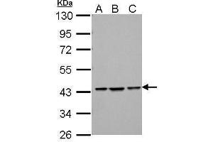 WB Image Sample (30 ug of whole cell lysate) A: NIH-3T3 B: JC C: BCL-1 10% SDS PAGE antibody diluted at 1:1000 (ZBTB24 antibody  (C-Term))