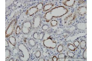 Immunoperoxidase of monoclonal antibody to DLD on formalin-fixed paraffin-embedded human kidney. (DLD antibody  (AA 1-509))
