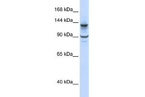 WB Suggested Anti-PGBD1 Antibody Titration:  0. (PGBD1 antibody  (N-Term))
