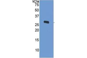 WB of Protein Standard: different control antibodies against Highly purified E. (ODC1 ELISA Kit)